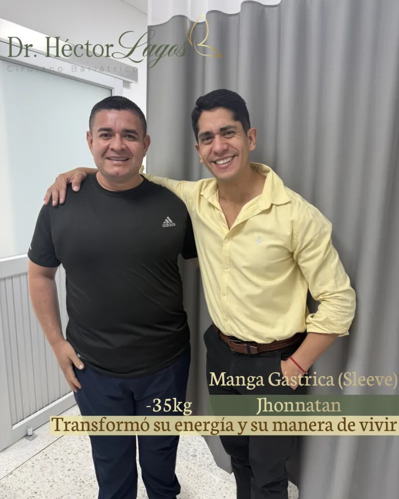 Jhonnatan, resultado después de su cirugía bariátrica