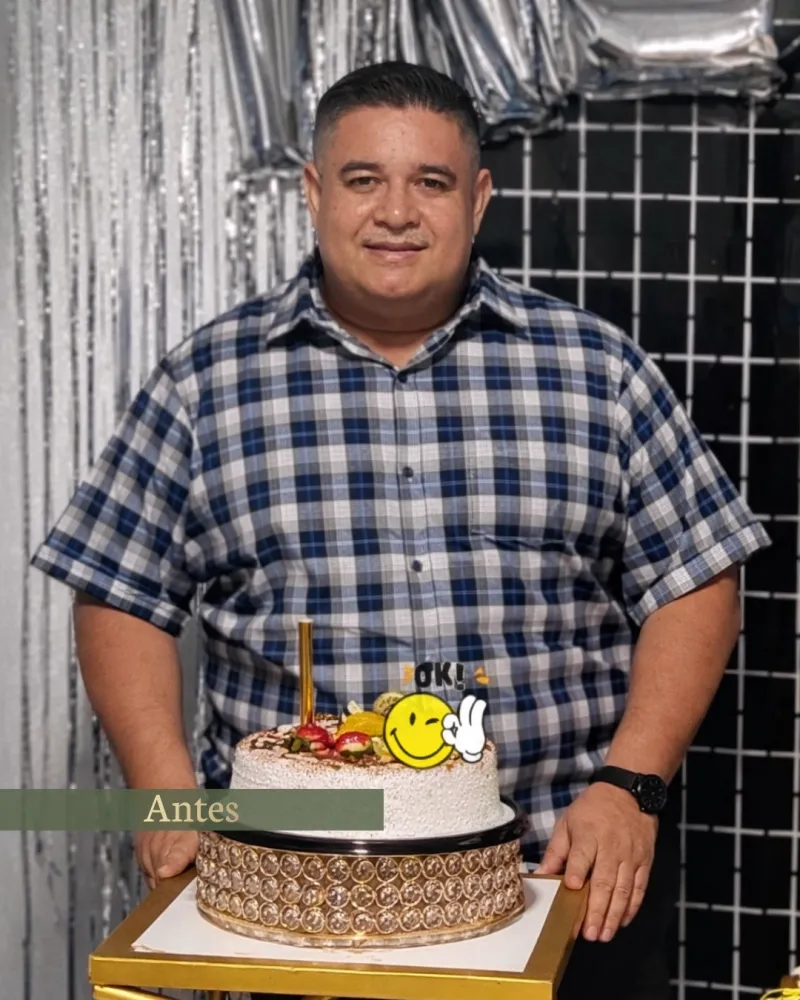 Jhonnatan antes de su cirugía bariátrica