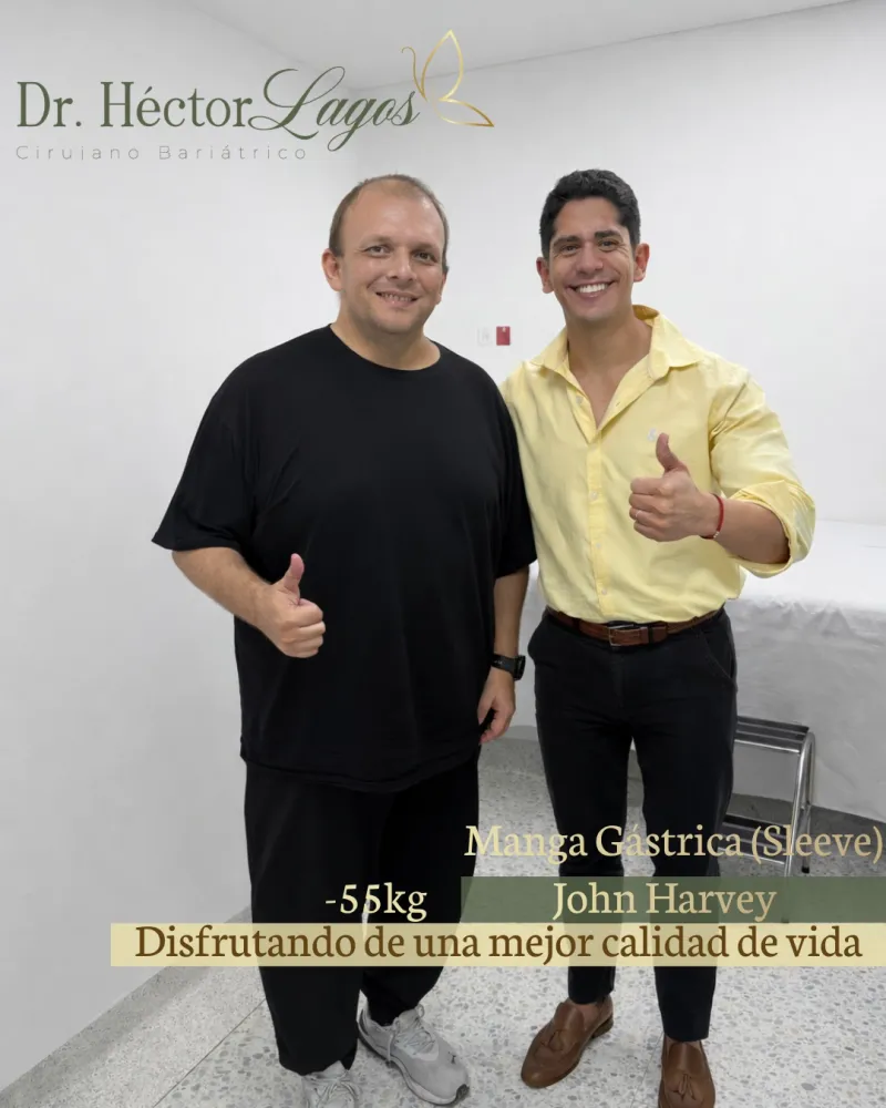 John Harvey, resultado después de su cirugía bariátrica