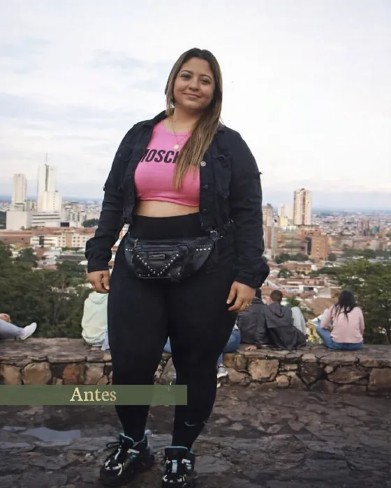 Paola antes de su cirugía bariátrica